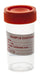 Urine Container 30ml.