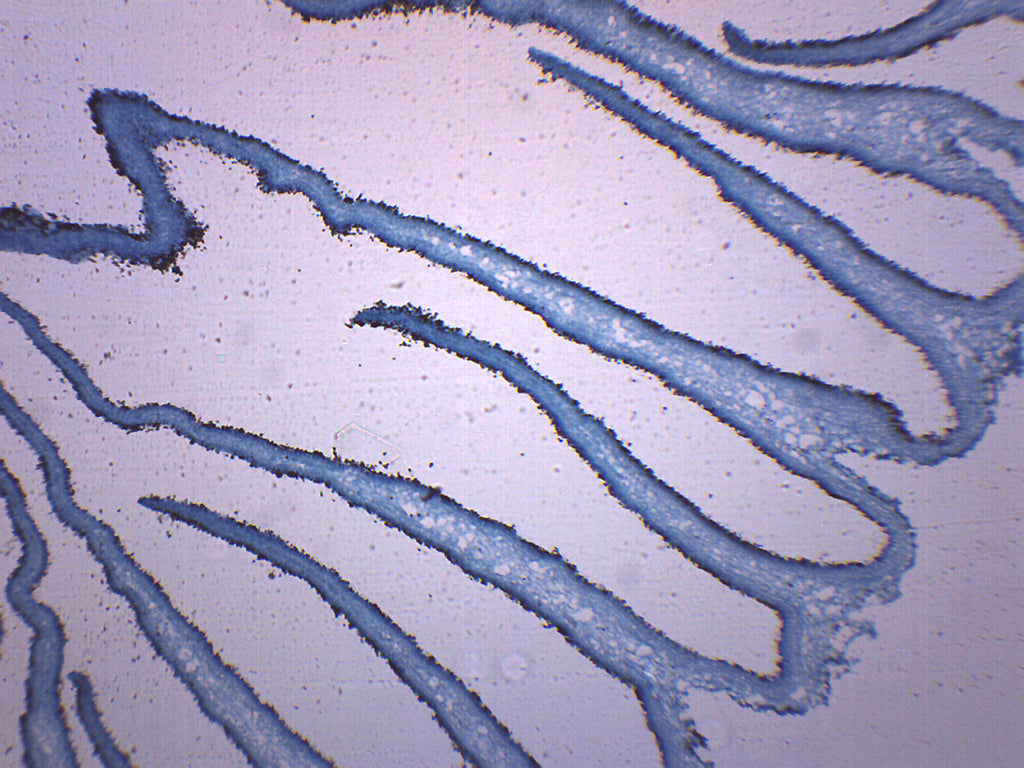 mushroom under microscope labeled