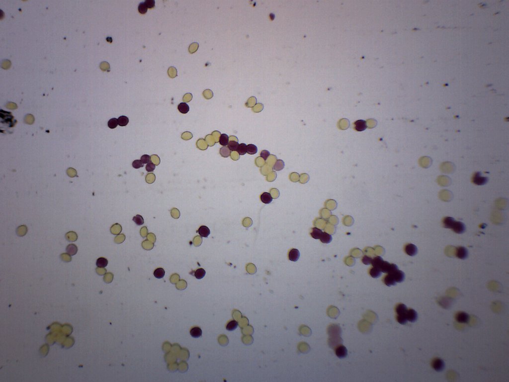 roundworms eggs in humans